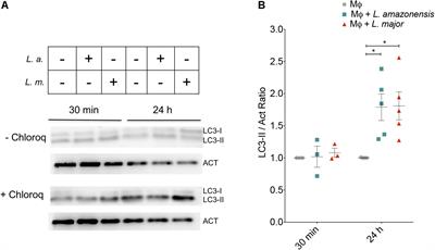 Autophagic Induction Greatly Enhances Leishmania major Intracellular Survival Compared to Leishmania amazonensis in CBA/j-Infected Macrophages